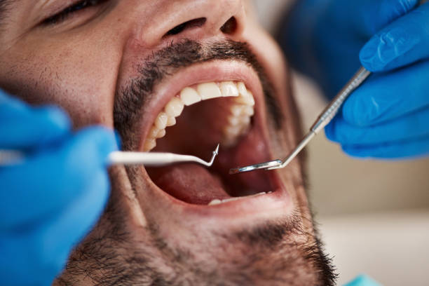 Best Dental Bonding  in Danvers, IL