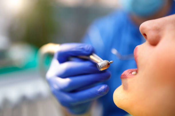Dental Bonding in Danvers, IL